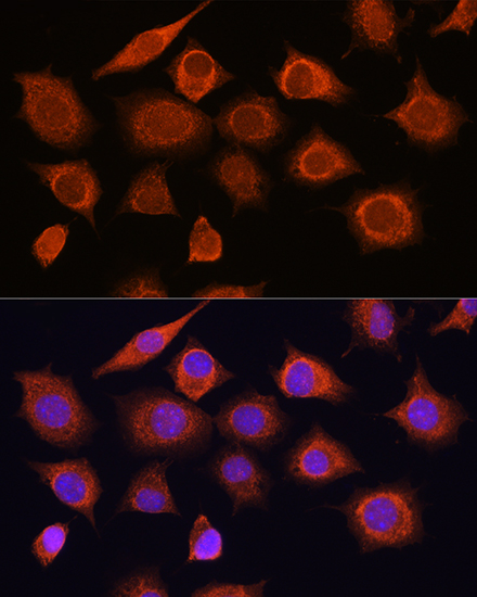 Anti-RIG-I / DDX58 Antibody (CAB0550)