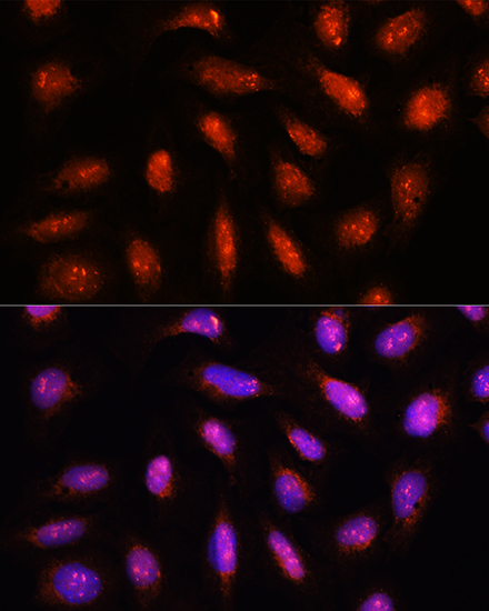 Anti-COPS8 Antibody (CAB12745)