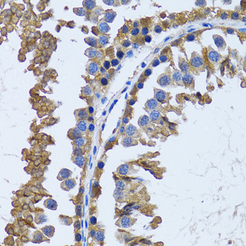 Anti-IMPA1 Antibody (CAB6381)