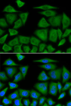 Anti-BIM Antibody (CAB0295)