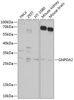 Anti-GNPDA2 Polyclonal Antibody (CAB9245)