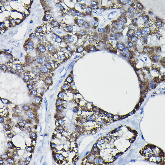 Anti-GSTK1 Antibody (CAB5226)