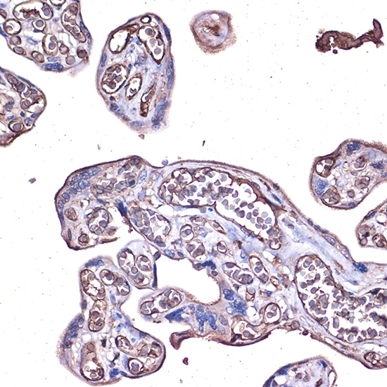 Anti-PD-L1 Antibody (CAB11273)