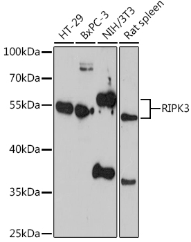 Anti-RIPK3 Antibody (CAB12996)