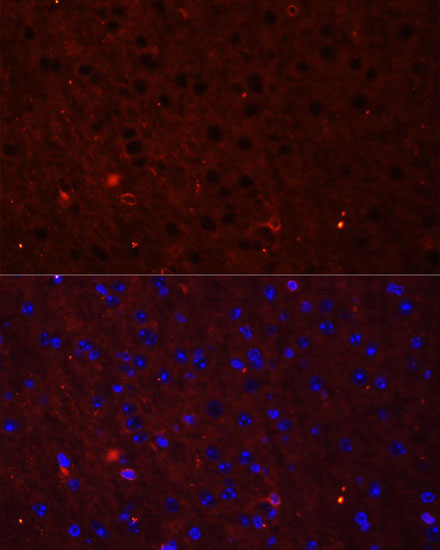 Anti-GRIA2 Antibody (CAB0111)