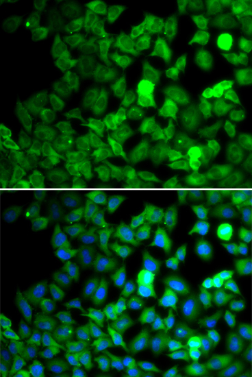 Anti-SARS Antibody (CAB13350)