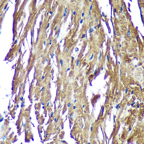 Anti-NDUFAF4 Antibody (CAB14345)