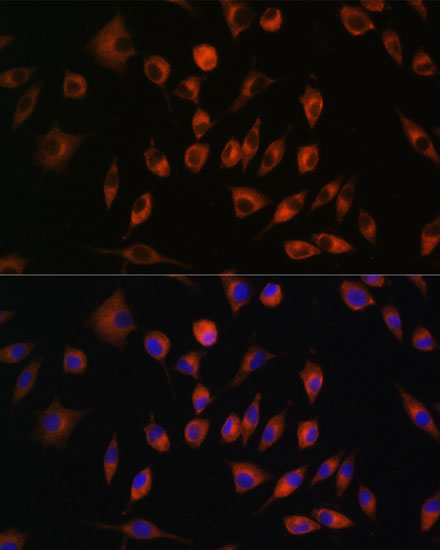 Anti-TRIM4 Antibody (CAB15922)