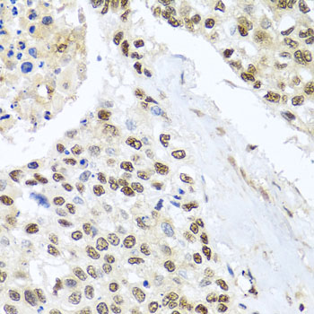 Anti-BNIP3L Antibody (CAB6283)