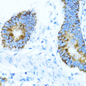 Anti-NOX1 Antibody (CAB11966)