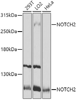 Anti-NOTCH2 Antibody (CAB0560)