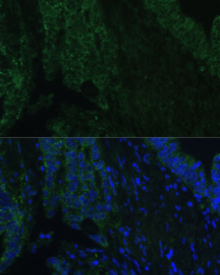 Anti-CLCA1 Antibody (CAB15041)