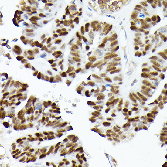 Anti-p53 Antibody [KO Validated] (CAB5761)