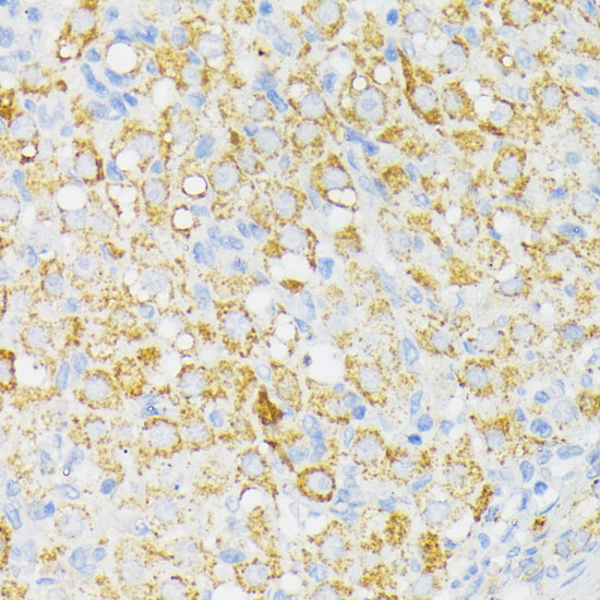 Anti-USP33 Antibody (CAB16187)