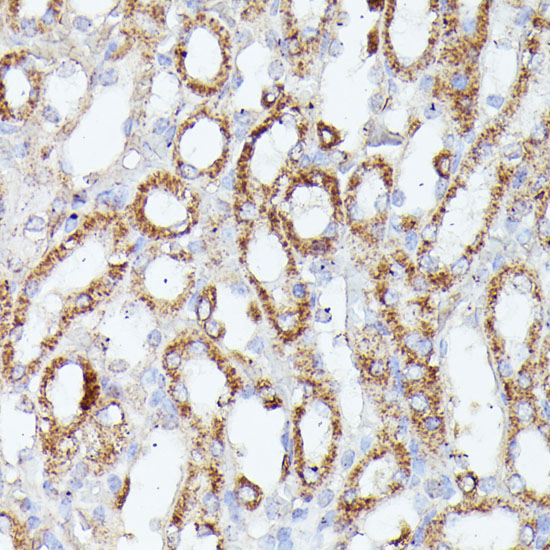 Anti-CDK5RAP1 Antibody (CAB15844)