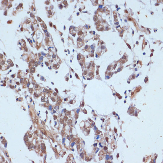 Anti-TP53BP2 Antibody (CAB5704)