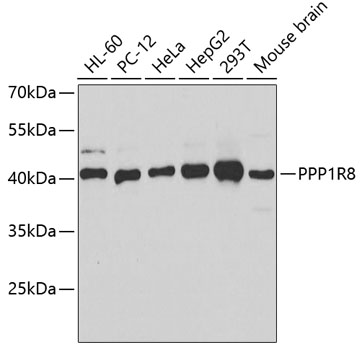 Anti-PPP1R8 Antibody (CAB6701)