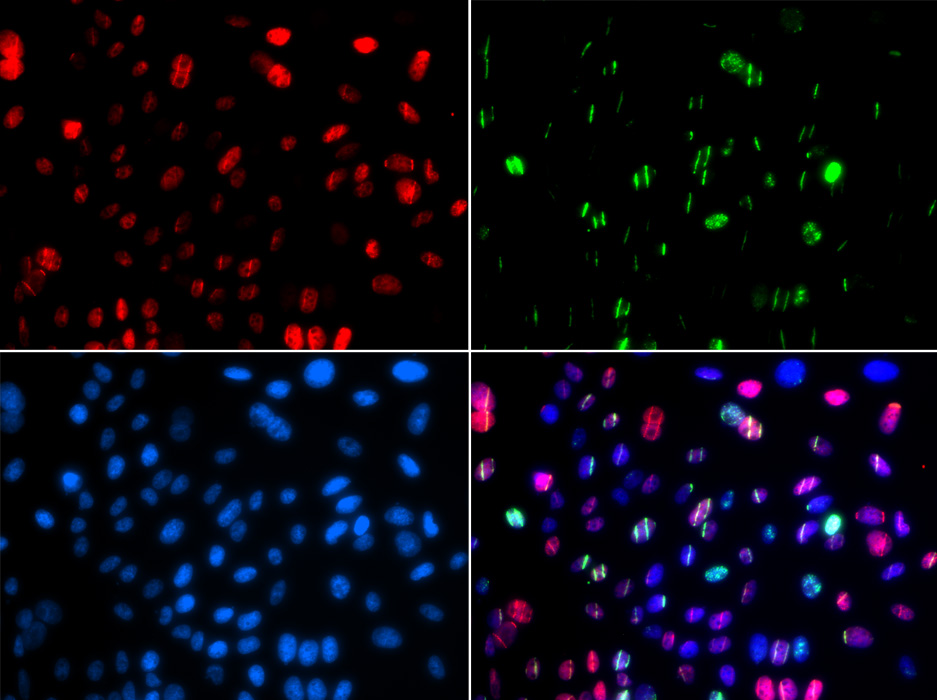 Anti-Phospho-p53-S15 Antibody (CABP0083)