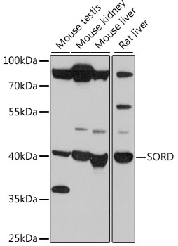 Anti-SORD Antibody (CAB15727)