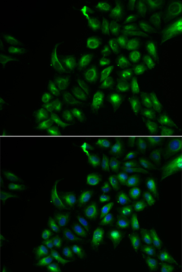 Anti-TSPAN7 Antibody (CAB13554)