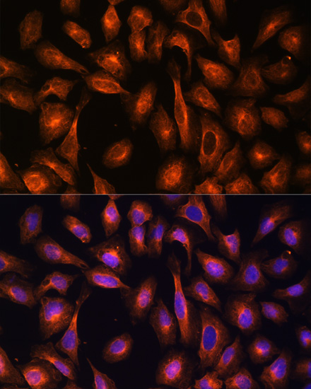 Anti-SPTAN1 Antibody (CAB0160)