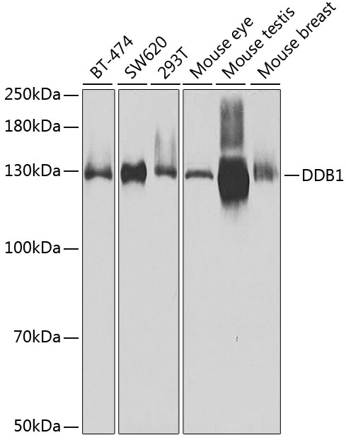 Anti-DDB1 Antibody (CAB2896)