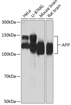 Anti-APP Rabbit Monoclonal Antibody [KO Validated] (CAB17911)