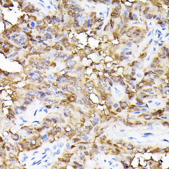 Anti-Ferritin Heavy Chain Antibody (CAB1144)