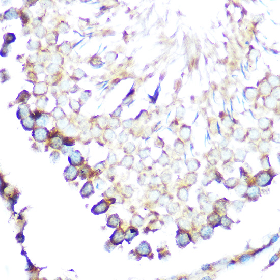 Anti-STIP1 Antibody (CAB1219)