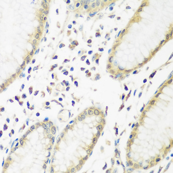 Anti-PYCR1 Antibody (CAB13346)