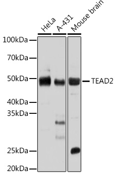 Anti-TEAD2 Antibody (CAB17407)