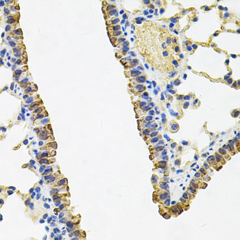 Anti-ACSS2 Antibody (CAB13596)