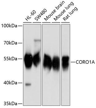 Anti-Coronin-1A Polyclonal Antibody (CAB9300)