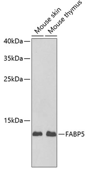 Anti-FABP5 Antibody (CAB6373)