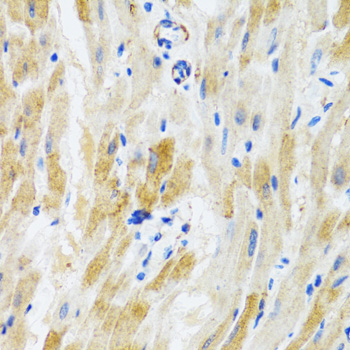 Anti-PHPT1 Antibody (CAB1127)