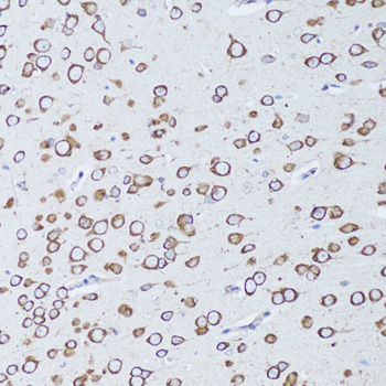 Anti-TNFRSF11A Antibody (CAB13382)