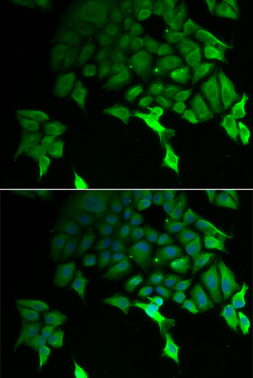 Anti-TSC22D3 Antibody (CAB6779)