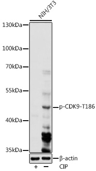 Anti-Phospho-CDK9-T186 pAb (CABP0810)