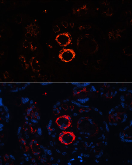 Anti-MYH11 Antibody (CAB10827)