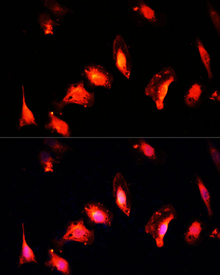 Anti-MYST1 Antibody (CAB2208)