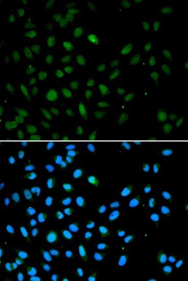 Anti-EZH1 Antibody (CAB5818)