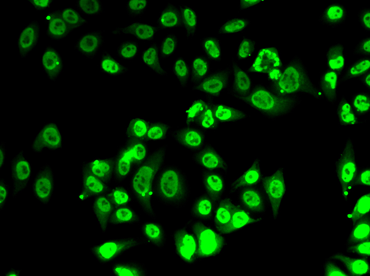 Anti-FIP1L1 Antibody (CAB7138)