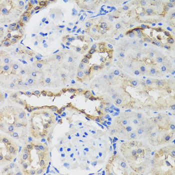 Anti-B9D1 Polyclonal Antibody (CAB7973)