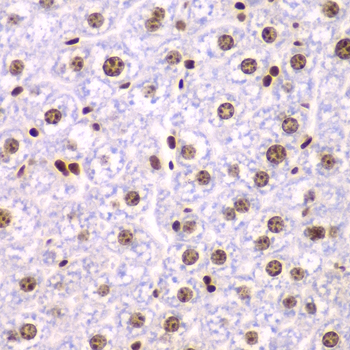 Anti-SSRP1 Antibody (CAB6413)