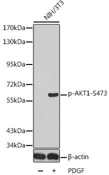 Anti-Phospho-AKT1-S473 Antibody (CABP0140)