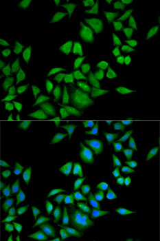 Anti-QDPR Antibody (CAB5733)