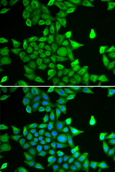 Anti-PSMA6 Antibody (CAB13536)