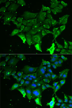 Anti-GRK6 Antibody (CAB6379)