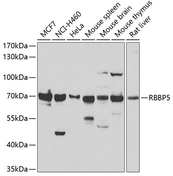 Anti-RBBP5 Antibody (CAB6965)