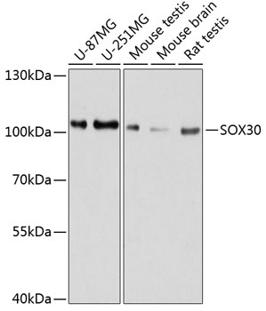 Anti-SOX30 Antibody (CAB11715)